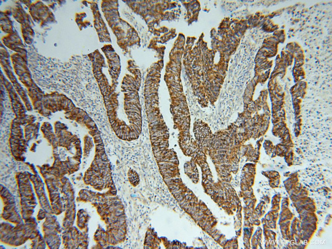 TST Antibody in Immunohistochemistry (Paraffin) (IHC (P))