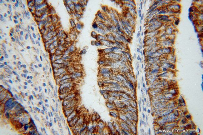 TST Antibody in Immunohistochemistry (Paraffin) (IHC (P))