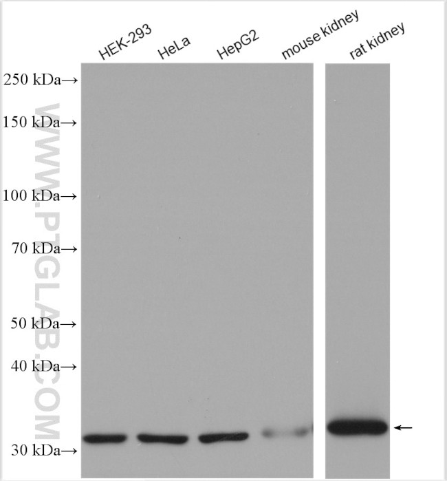 TST Antibody in Western Blot (WB)