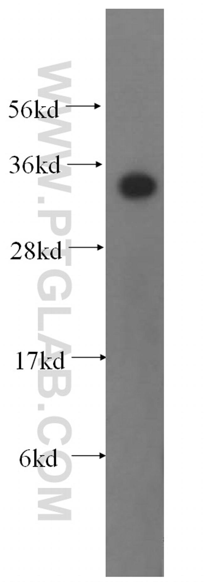 TST Antibody in Western Blot (WB)