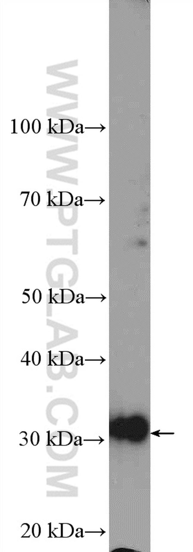 TST Antibody in Western Blot (WB)