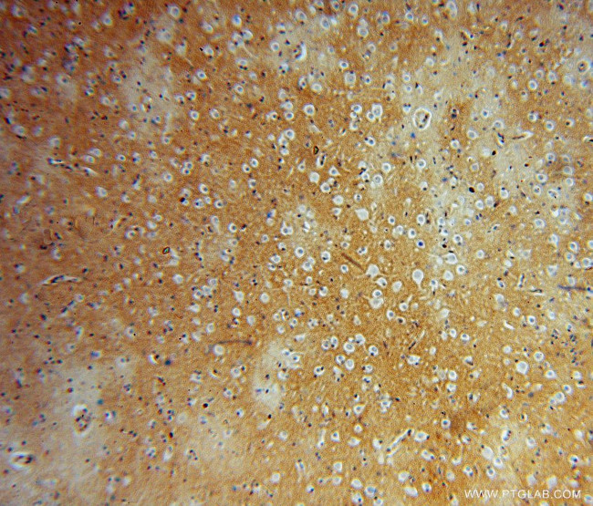 FN3KRP Antibody in Immunohistochemistry (Paraffin) (IHC (P))