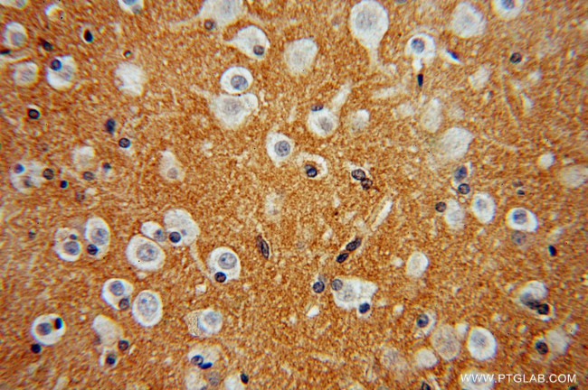 FN3KRP Antibody in Immunohistochemistry (Paraffin) (IHC (P))