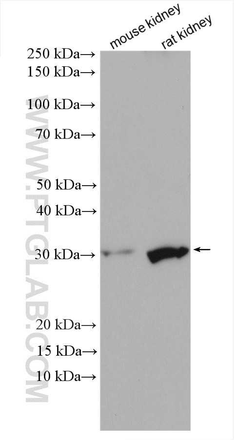 FN3KRP Antibody in Western Blot (WB)