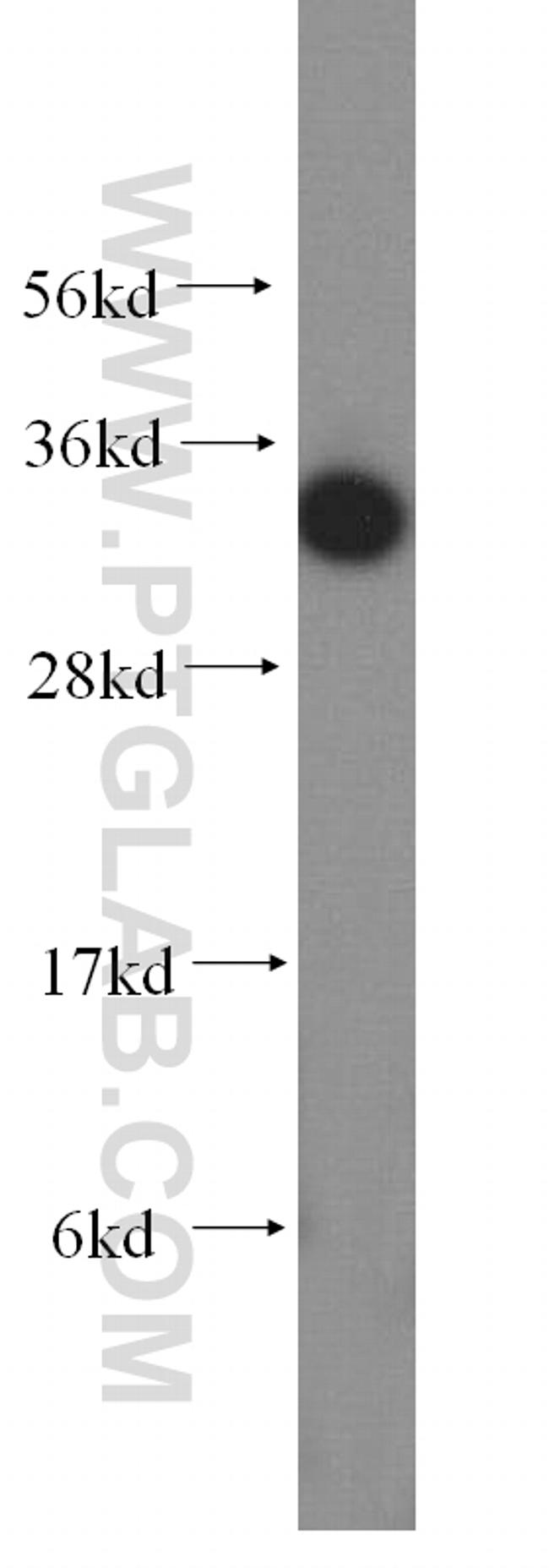 FN3KRP Antibody in Western Blot (WB)