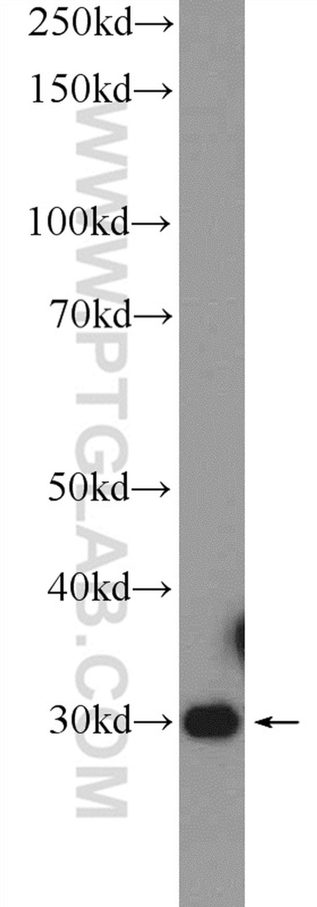 FN3KRP Antibody in Western Blot (WB)