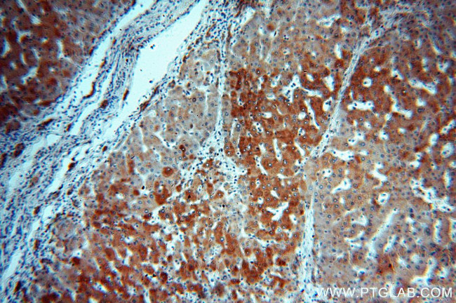 dGK Antibody in Immunohistochemistry (Paraffin) (IHC (P))