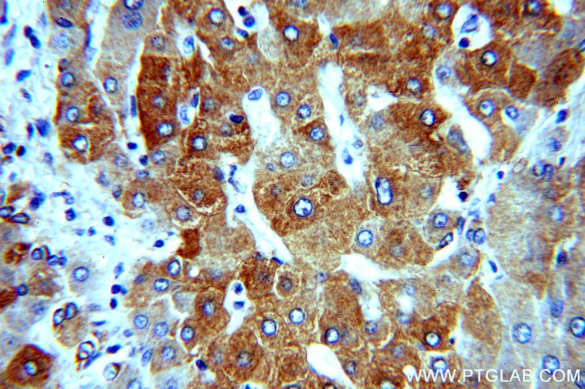 dGK Antibody in Immunohistochemistry (Paraffin) (IHC (P))