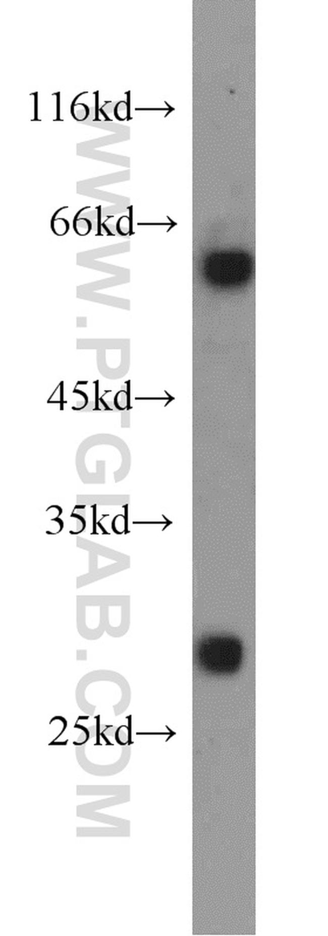 dGK Antibody in Western Blot (WB)