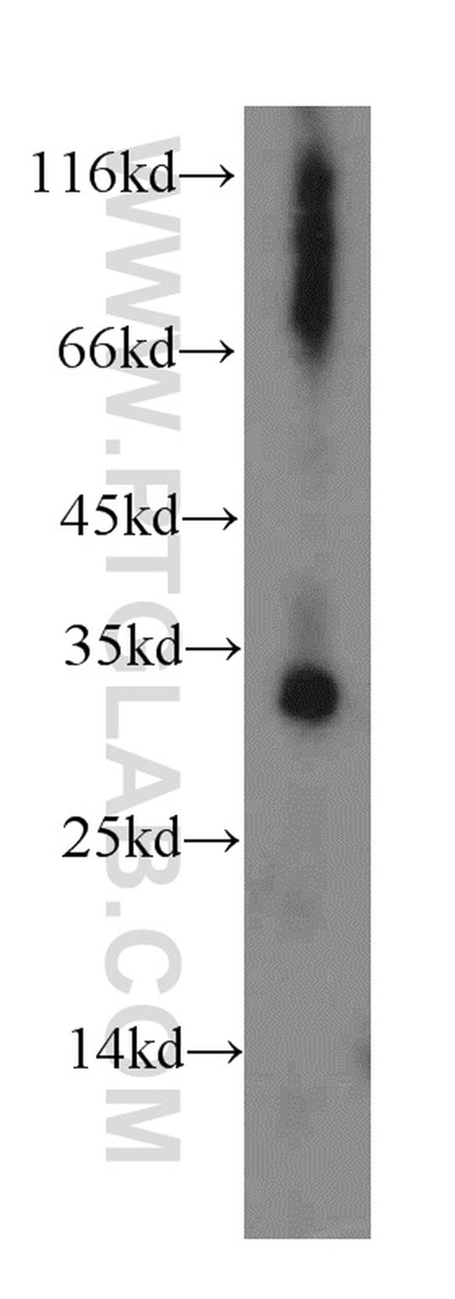 dGK Antibody in Western Blot (WB)