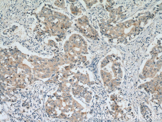 BACE2 Antibody in Immunohistochemistry (Paraffin) (IHC (P))