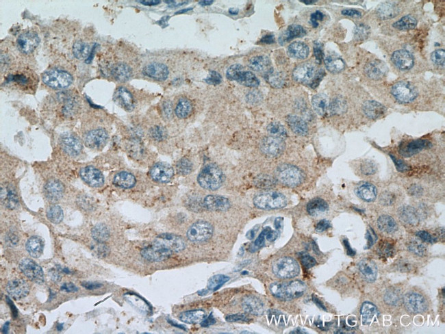 BACE2 Antibody in Immunohistochemistry (Paraffin) (IHC (P))