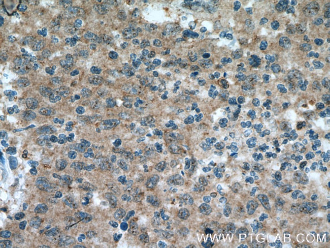 BACE2 Antibody in Immunohistochemistry (Paraffin) (IHC (P))