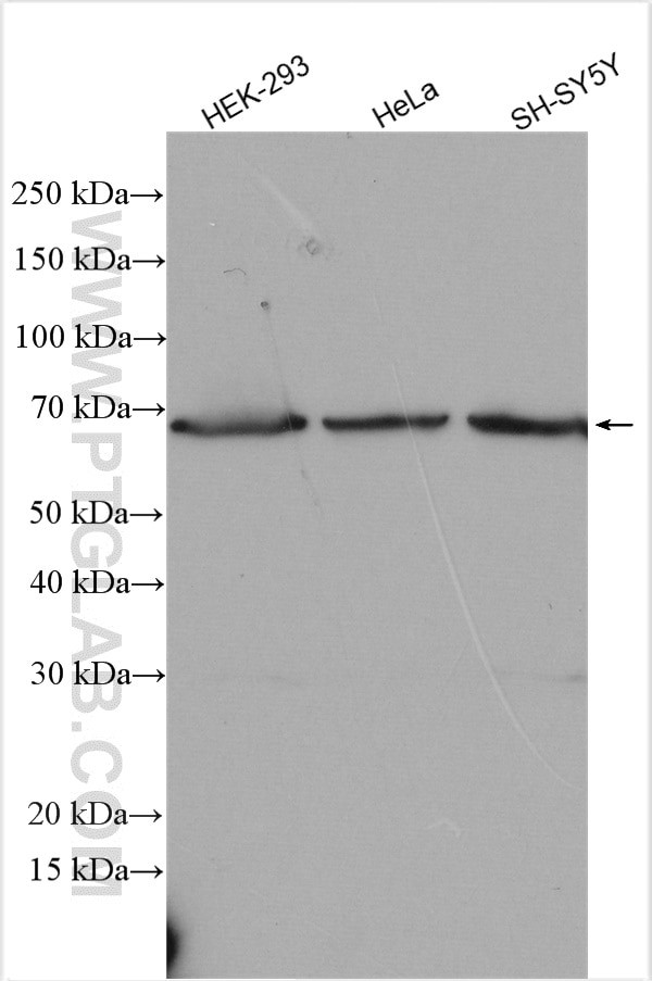 BACE2 Antibody in Western Blot (WB)