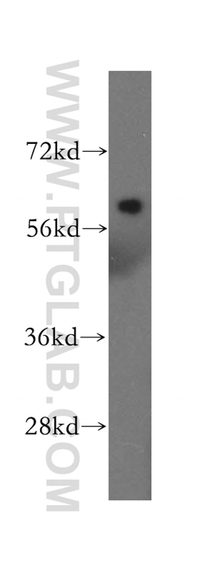 BACE2 Antibody in Western Blot (WB)