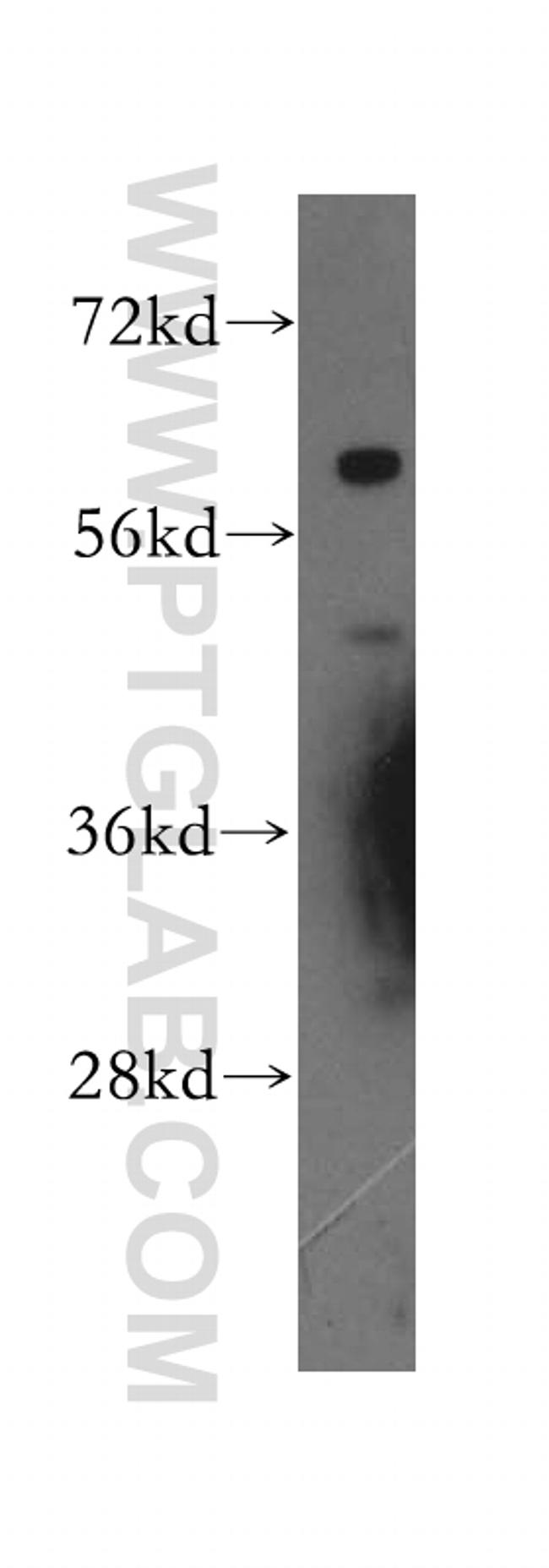 BACE2 Antibody in Western Blot (WB)