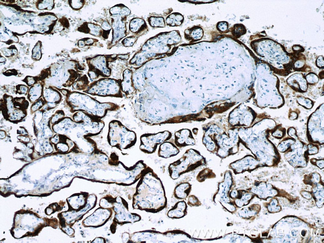 Placental lactogen Antibody in Immunohistochemistry (Paraffin) (IHC (P))