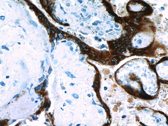 Placental lactogen Antibody in Immunohistochemistry (Paraffin) (IHC (P))