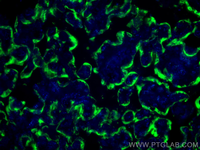 Placental lactogen Antibody in Immunohistochemistry (PFA fixed) (IHC (PFA))