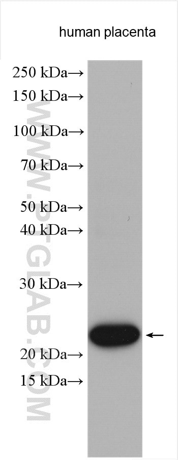 Placental lactogen Antibody in Western Blot (WB)