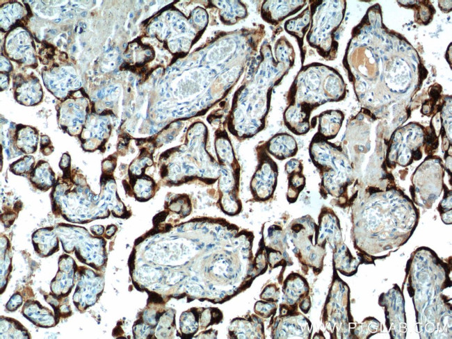 Placental lactogen Antibody in Immunohistochemistry (Paraffin) (IHC (P))