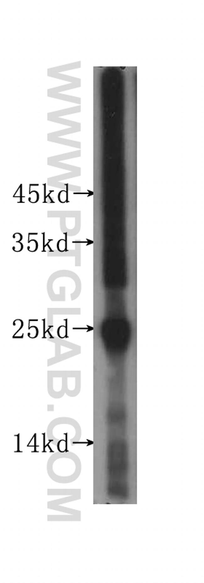 Placental lactogen Antibody in Western Blot (WB)