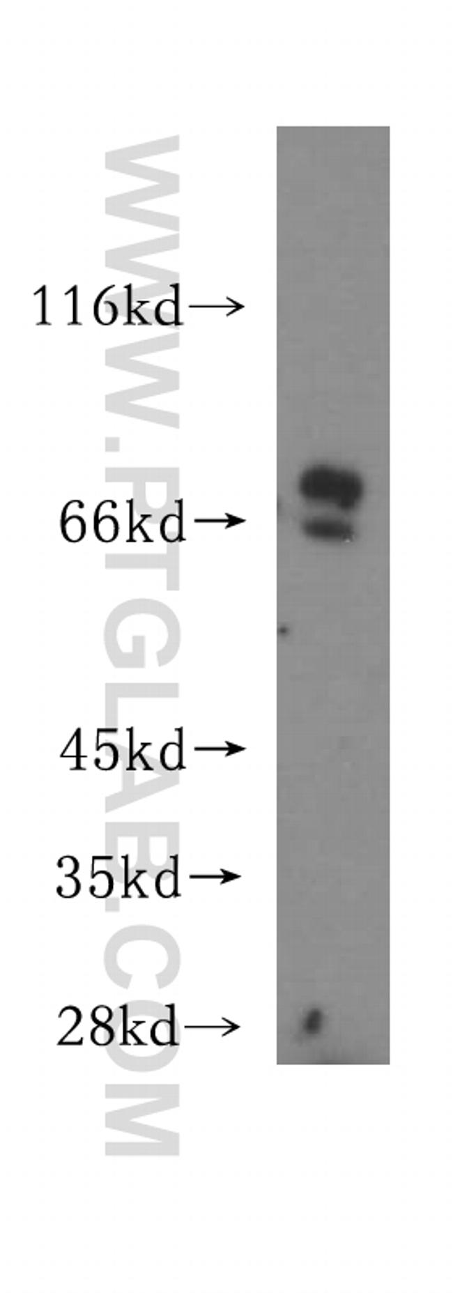 OCTN2 Antibody in Western Blot (WB)