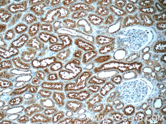 OCTN2 Antibody in Immunohistochemistry (Paraffin) (IHC (P))