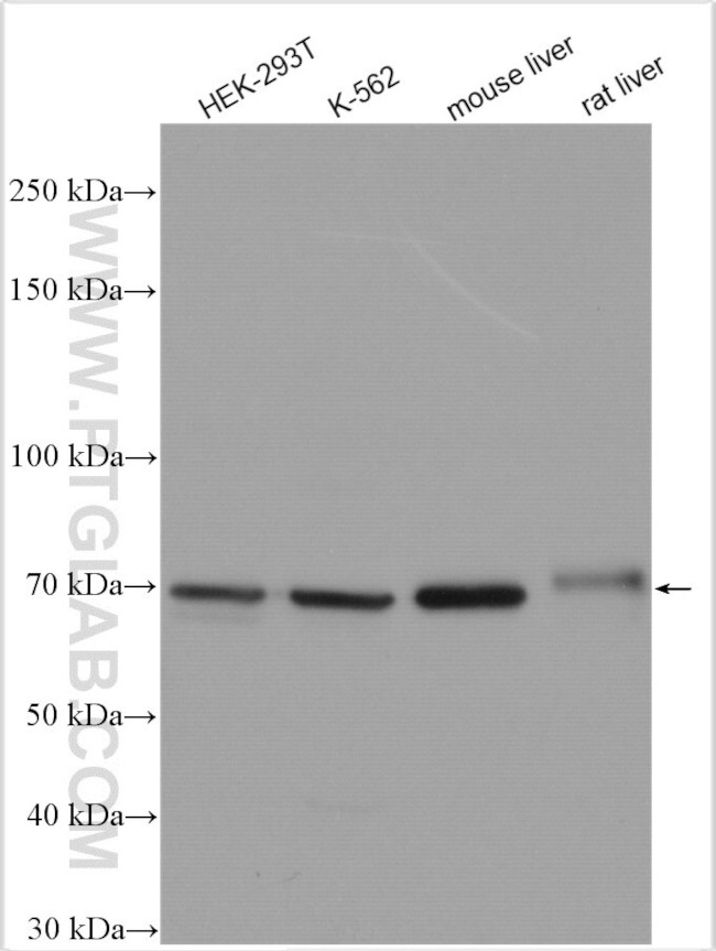 GUSB Antibody in Western Blot (WB)