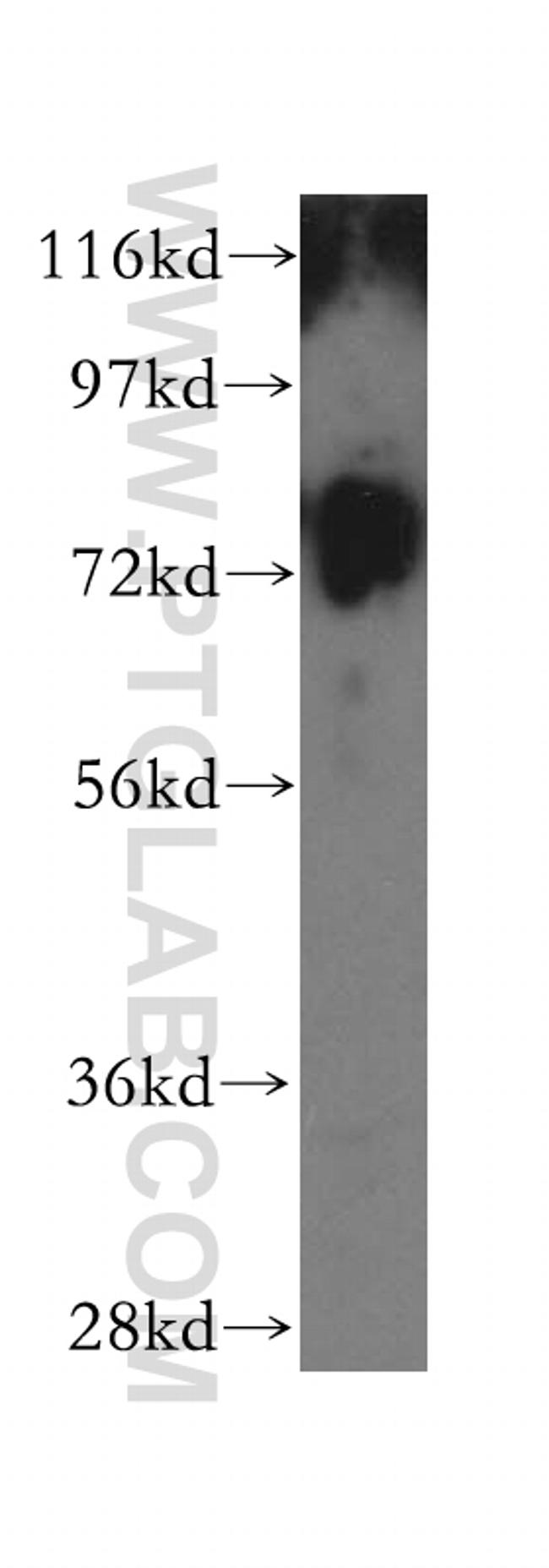 GUSB Antibody in Western Blot (WB)