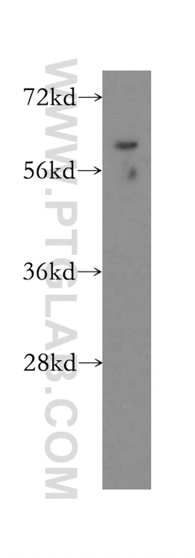 GUSB Antibody in Western Blot (WB)