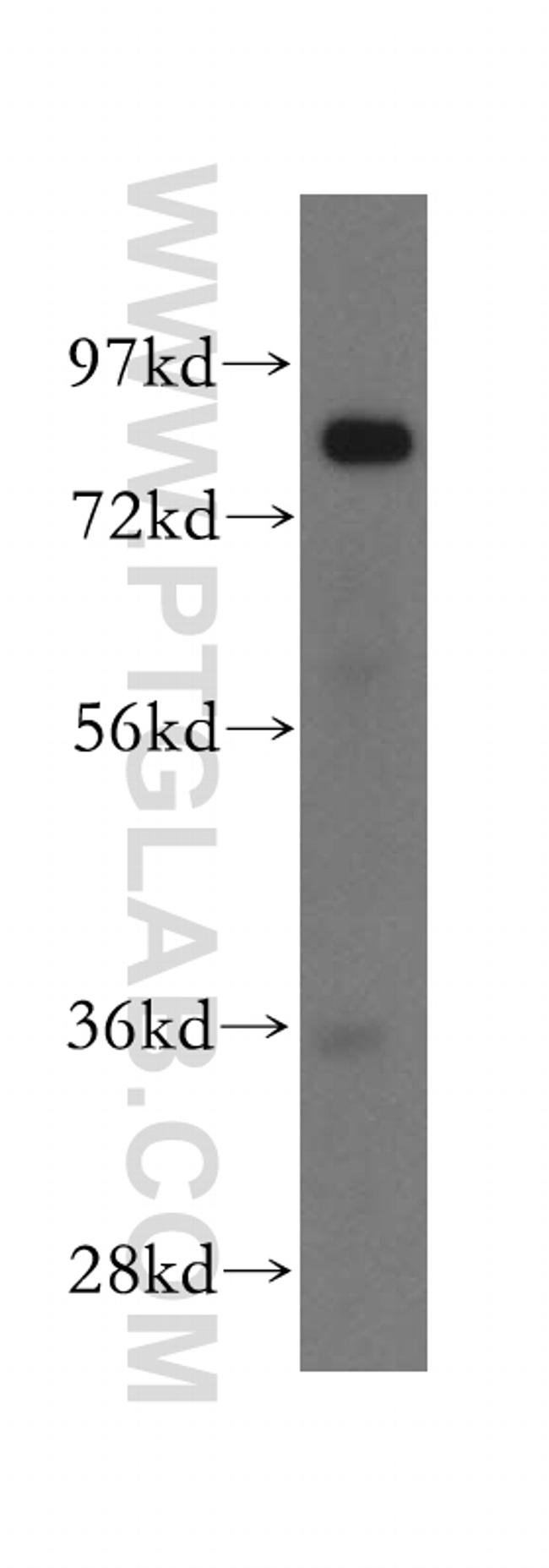 GUSB Antibody in Western Blot (WB)