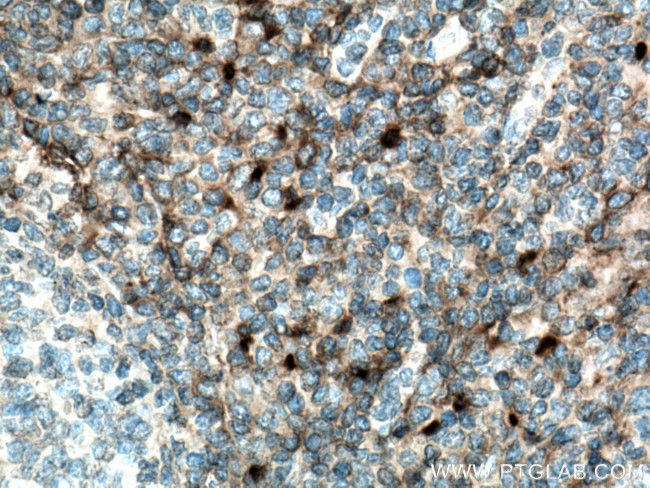 CD157 Antibody in Immunohistochemistry (Paraffin) (IHC (P))