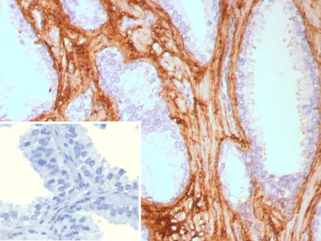 Decorin Antibody in Immunohistochemistry (Paraffin) (IHC (P))