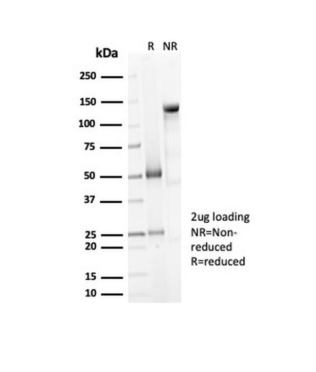 Decorin Antibody in Immunoelectrophoresis (IE)