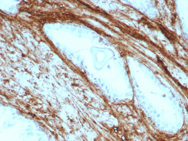 Decorin Antibody in Immunohistochemistry (Paraffin) (IHC (P))