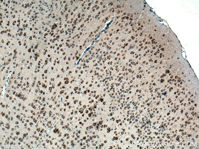 FARSB Antibody in Immunohistochemistry (Paraffin) (IHC (P))