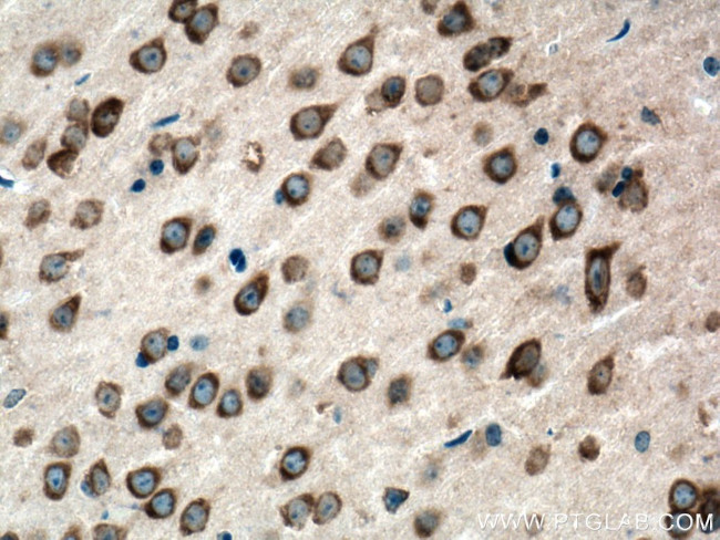 FARSB Antibody in Immunohistochemistry (Paraffin) (IHC (P))