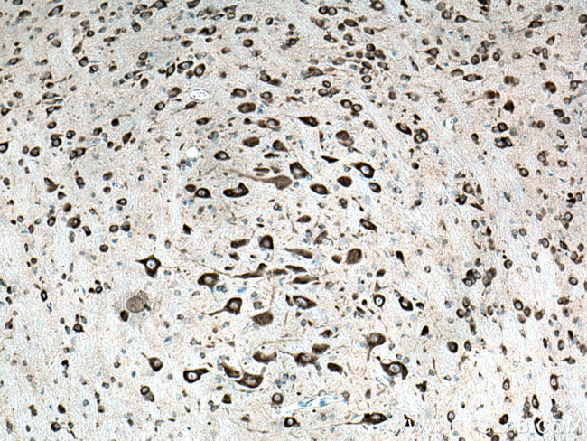 FARSB Antibody in Immunohistochemistry (Paraffin) (IHC (P))