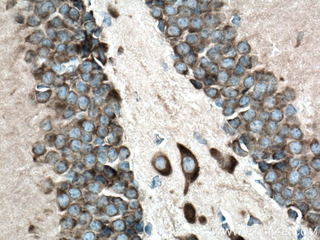 FARSB Antibody in Immunohistochemistry (Paraffin) (IHC (P))