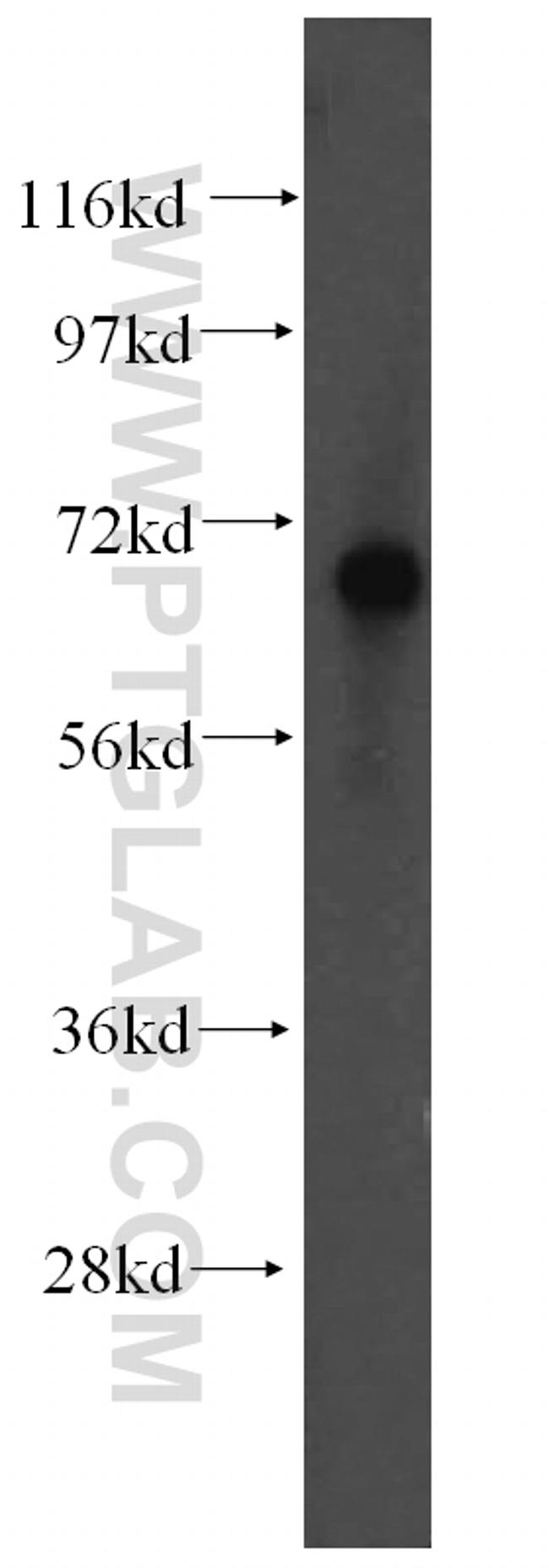 FARSB Antibody in Western Blot (WB)