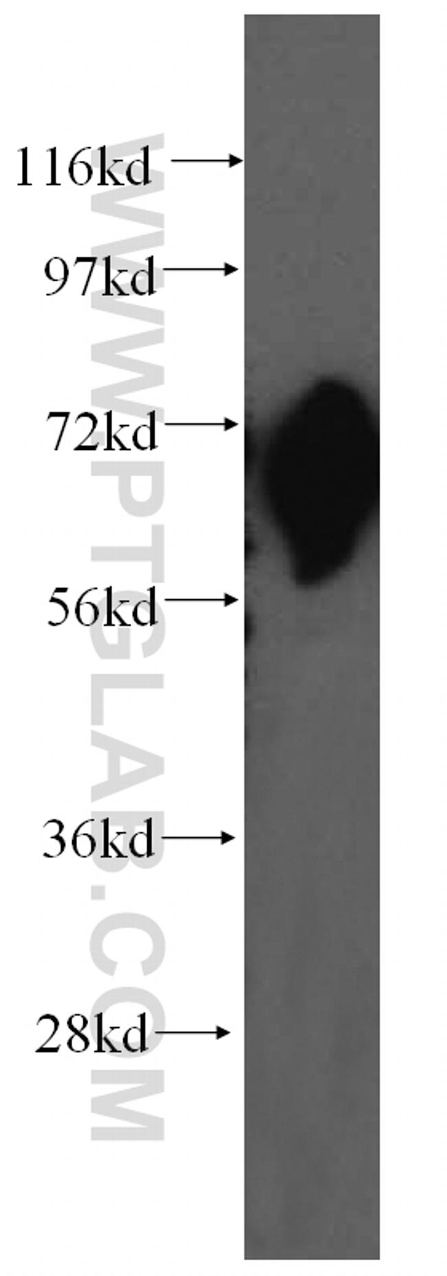 FARSB Antibody in Western Blot (WB)