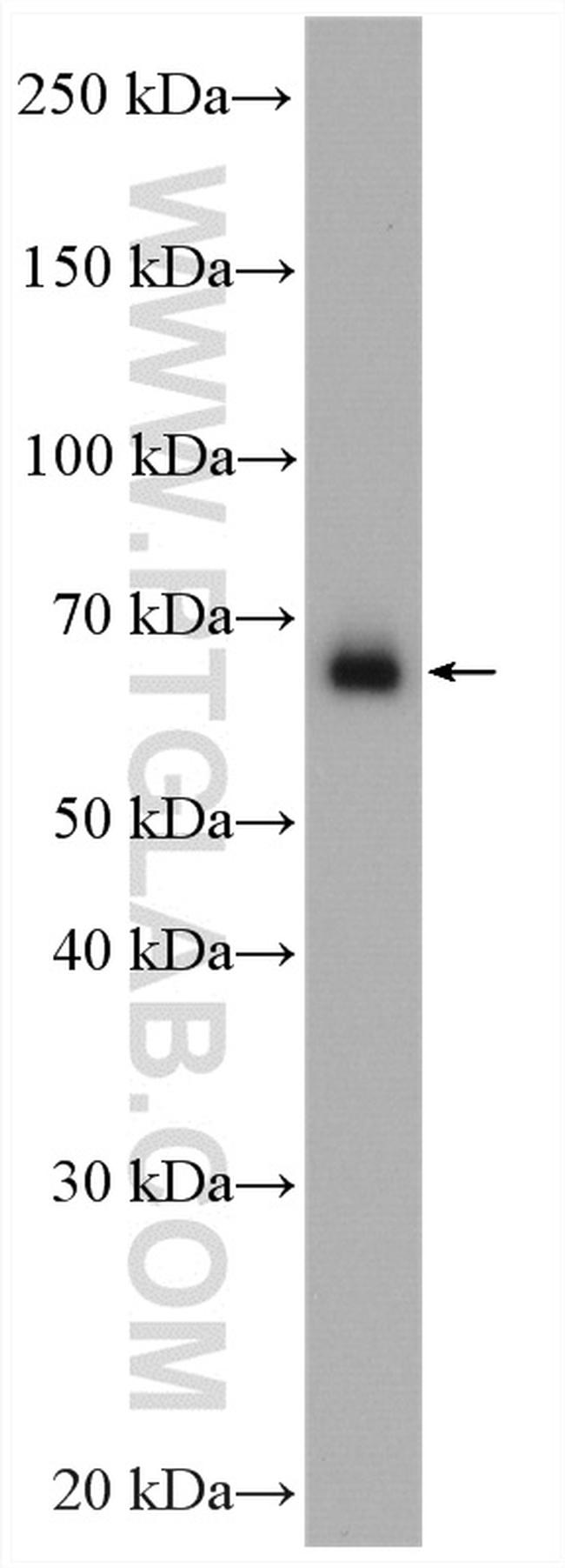 FARSB Antibody in Western Blot (WB)