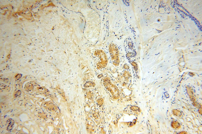 SLC35A1 Antibody in Immunohistochemistry (Paraffin) (IHC (P))