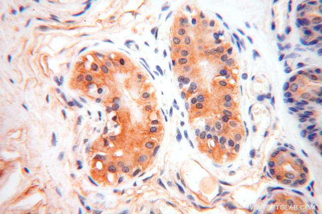 SLC35A1 Antibody in Immunohistochemistry (Paraffin) (IHC (P))