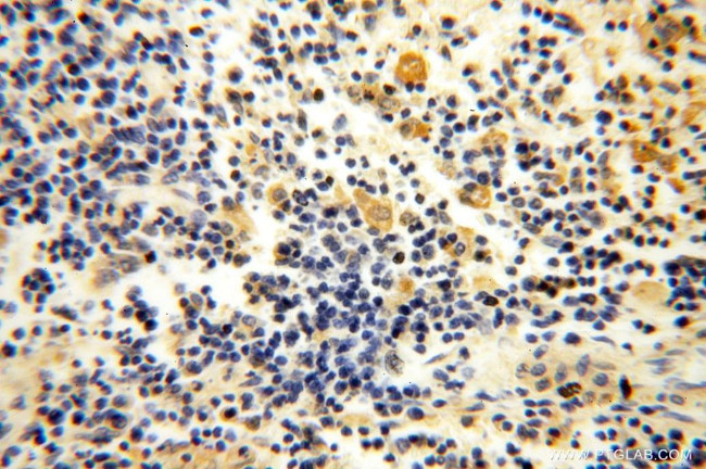 SLC35A1 Antibody in Immunohistochemistry (Paraffin) (IHC (P))