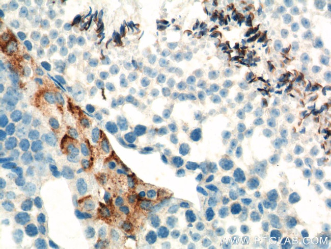 SLC35A1 Antibody in Immunohistochemistry (Paraffin) (IHC (P))