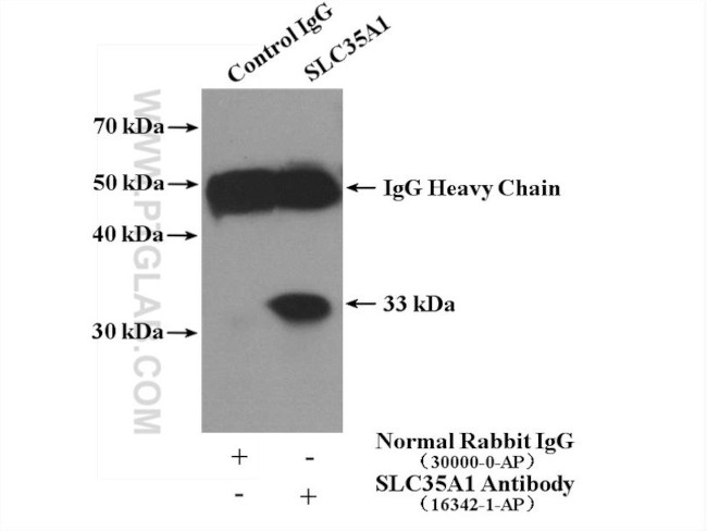 SLC35A1 Antibody in Immunoprecipitation (IP)