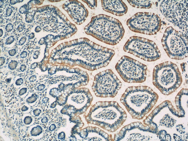 SLC3A1 Antibody in Immunohistochemistry (Paraffin) (IHC (P))