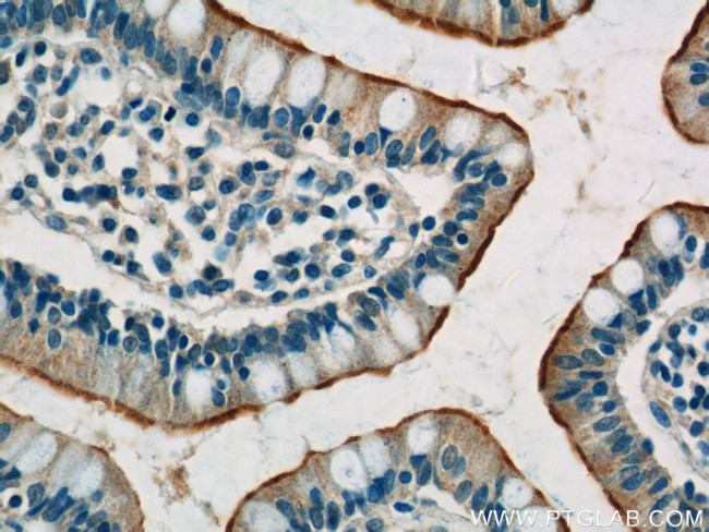 SLC3A1 Antibody in Immunohistochemistry (Paraffin) (IHC (P))